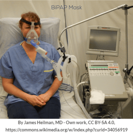 Bipap oxygen deals